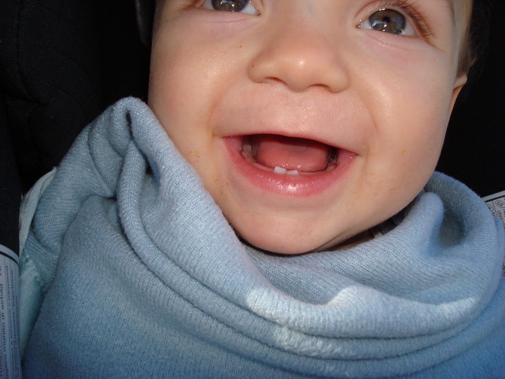 Efter Sverigesemestern tittade två tänder fram